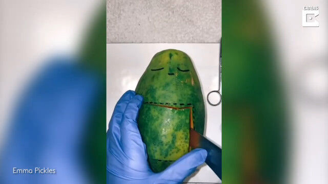 移植、摘出、出産。オーストラリアの12歳の少女による、野菜や果物を使った本気のお医者さんごっこ