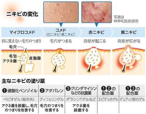 ﾆｷﾋﾞの変化