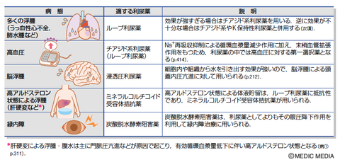 利尿剤の種類　ー１