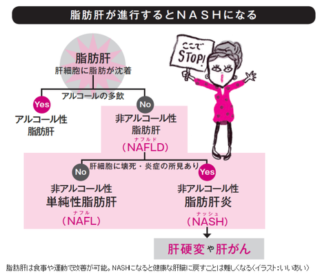 NASHから肝がんへ　　　－２