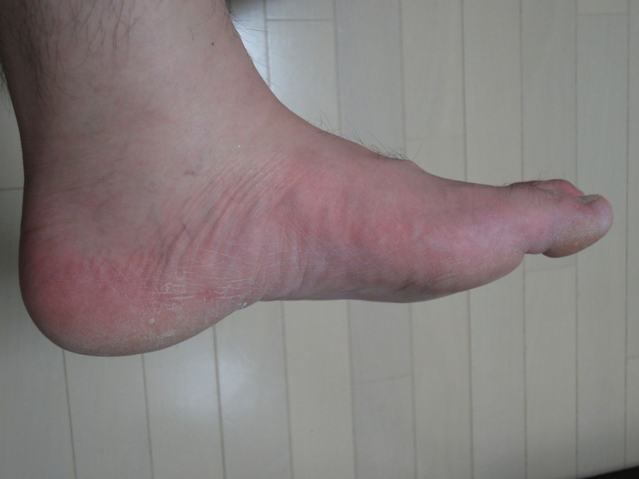 足裏ランラン Ashiura Ran Run 1日目 ﾟ ﾟ ﾟ こちゅばんban 9 のブログ