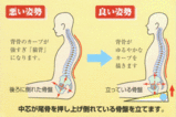 骨盤矯正