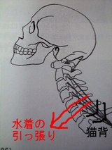 骨盤矯正