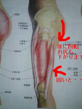 骨盤矯正