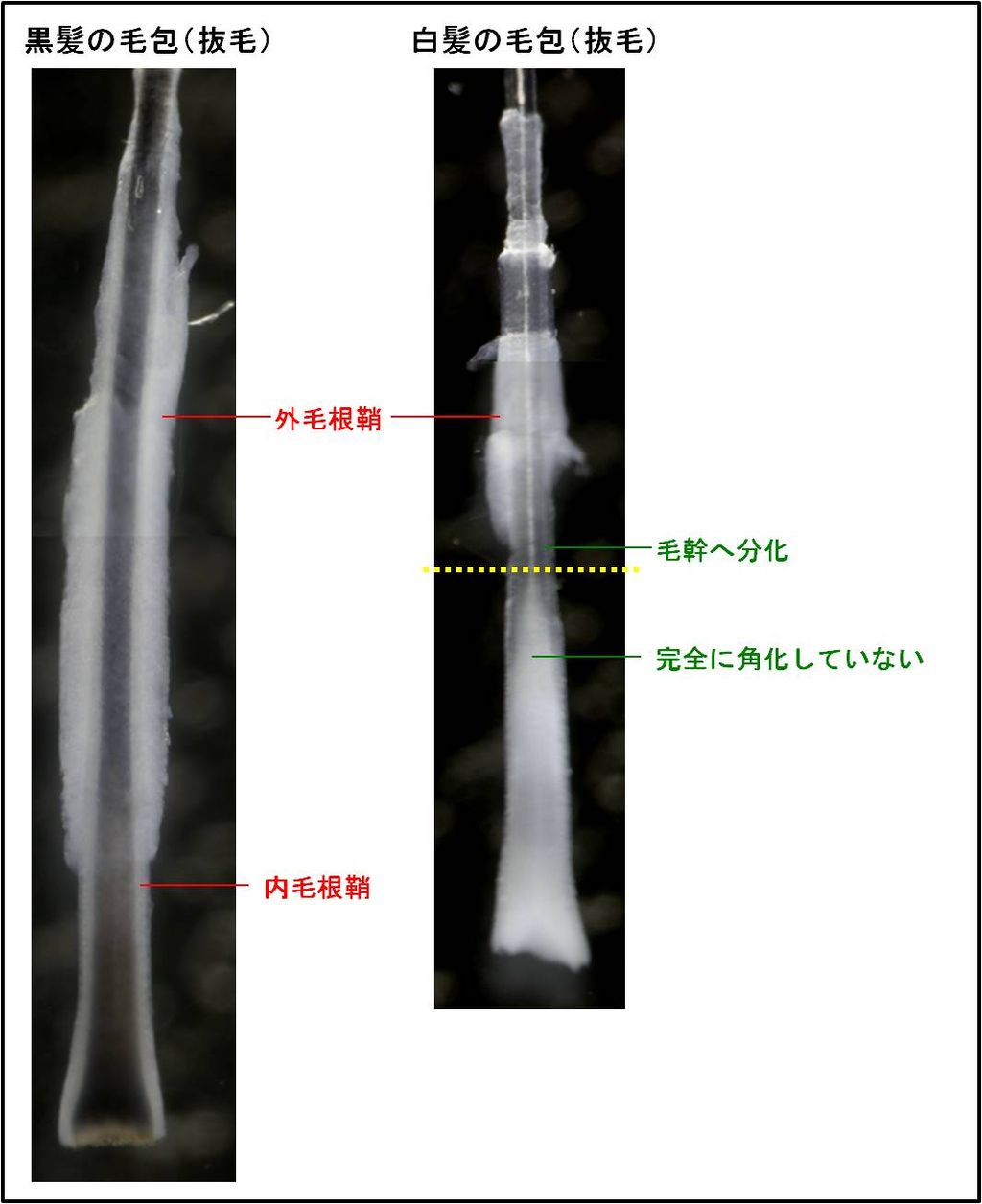 毛幹となっている場所はどこから 育毛 発毛 育毛剤について分析 ブログ