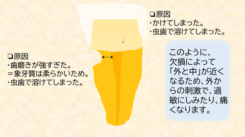 ひおjほじょ