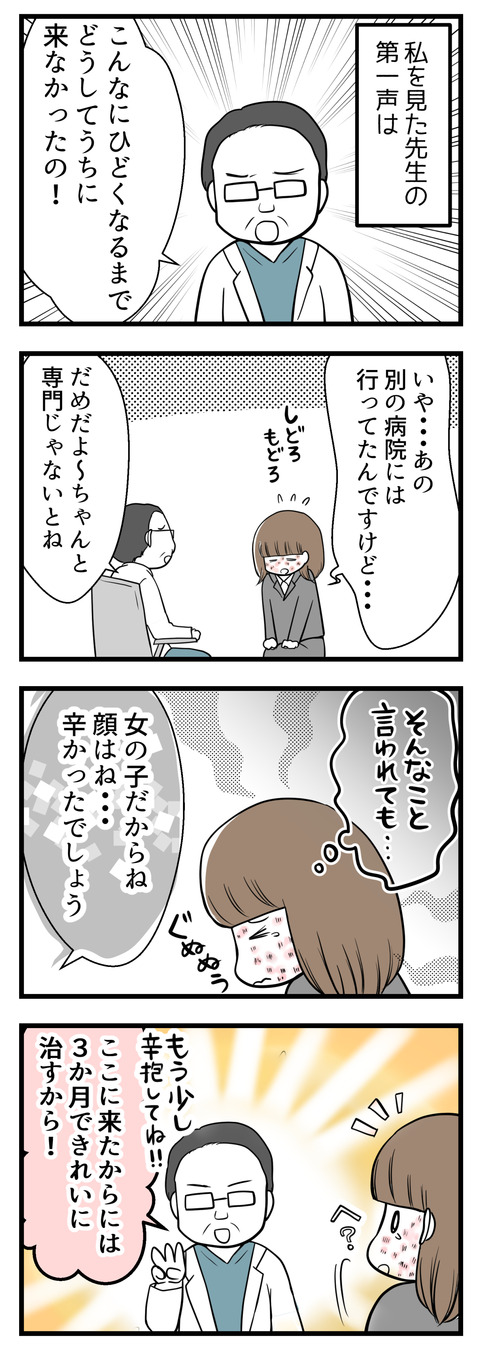 私の顔のかぶれを見た瞬間先生に「どうしてこんなになるまでうちにこなかったの?!」と怒られました