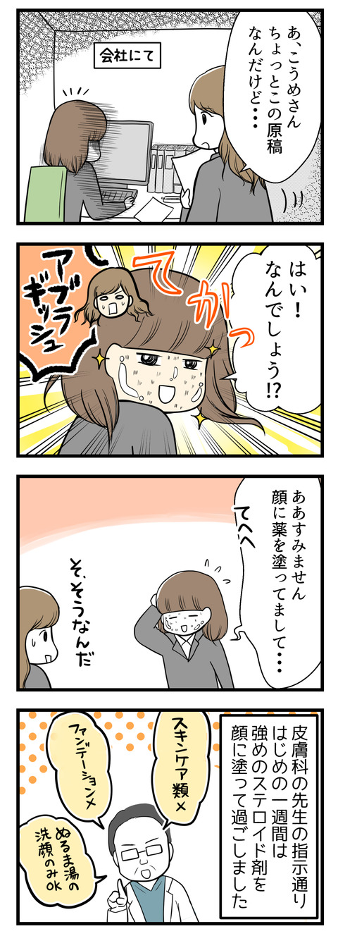 会社にて先輩に話しかけられて振り向いたら、アブラギッシュな顔に驚かれました。皮膚科の先生の言う通り、はじめの一週間は強めのステロイド外用薬を顔に塗ってスキンケアや化粧の類はいっさいせずに過ごしました