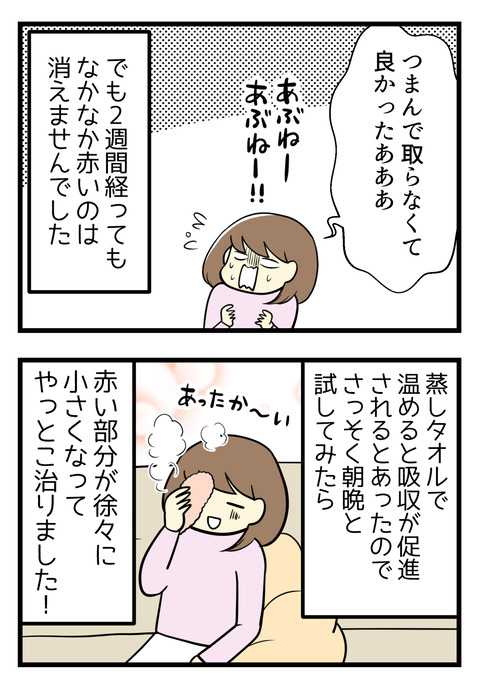でも私は2週間経ってもなかなか消えず。温かい蒸しタオルで目を温めると吸収が促進される、という情報をみて試したところ効果がありました!