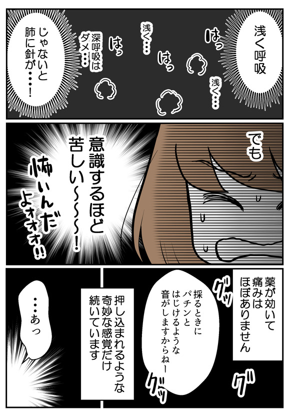 肝生検受けました13-1