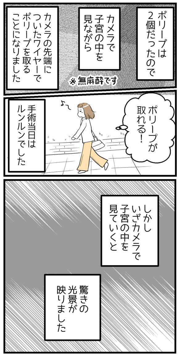ポリープの手術当日、ルンルンで挑んだものの、カメラで子宮の中を映してみるとそこには驚きの光景が広がっていました。