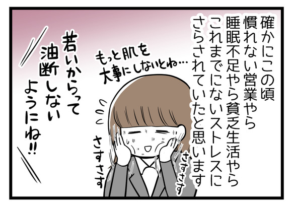 【ビンボーOL編16】節約のために百均の化粧水を使ってみたら-END-2