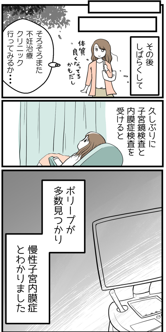 しばらく不妊鍼灸に通いしばらくして、再び不妊治療を再開。久しぶりに子宮鏡検査と内膜検査を受けてみるとポリープが見つかり、慢性子宮内膜症だとわかりました。