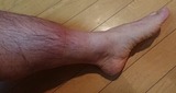 lower-leg-20200118