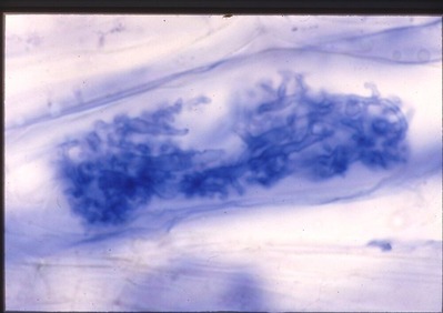 ���κ�˦���������