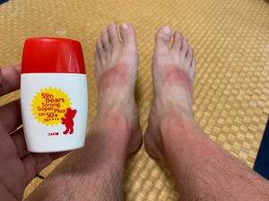 IMG_5539