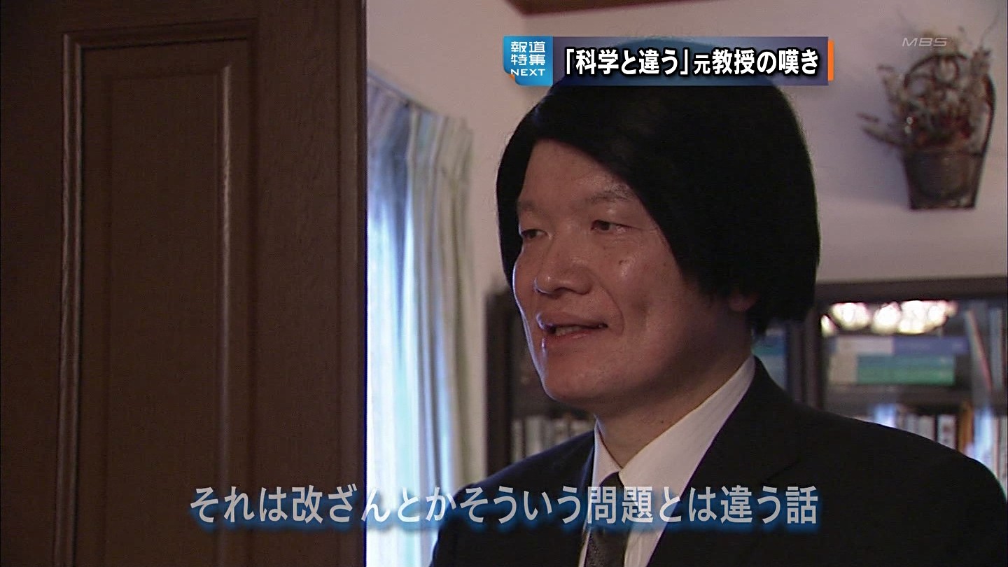 画像 筑波大の解雇を 違和感がある 科学的でない と断じる長照二教授の頭髪に科学的な違和感 2chまとめブログ クマ速報