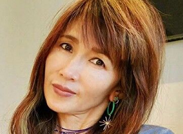 工藤静香が愛犬とのキスハグ動画を投稿するも 何か注入した とアンパンマンみたいな顔に注目が集まるｗ 今 気になっている事について書いてみた