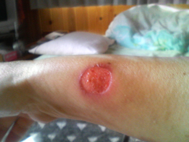 馬油の効能 ワンコとみちくさ