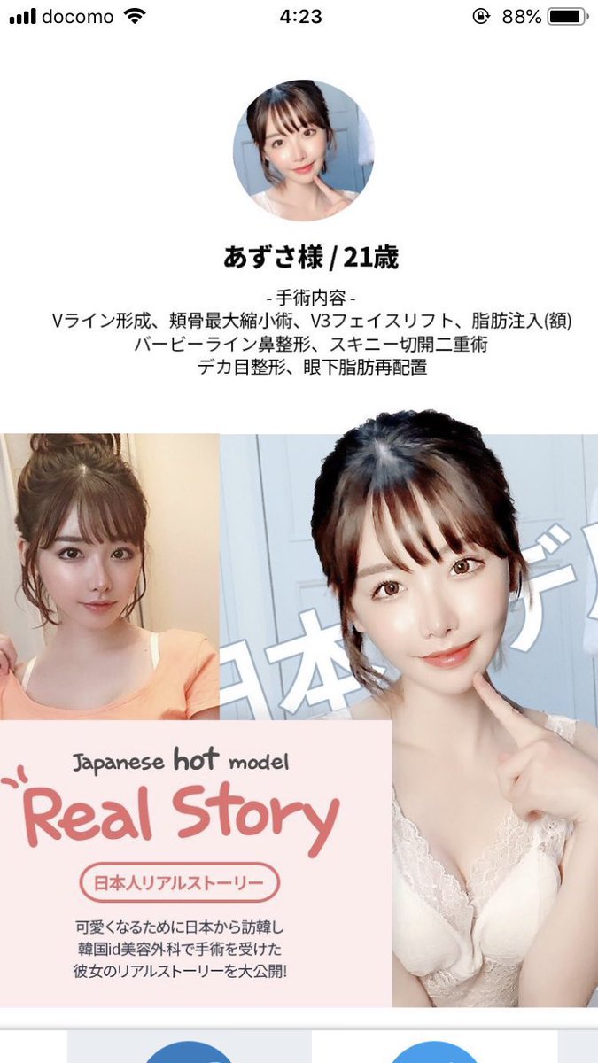 画像 あずささん 21歳 の例で見る美容整形の素晴らしさ 2ch野球まとめアンテナ