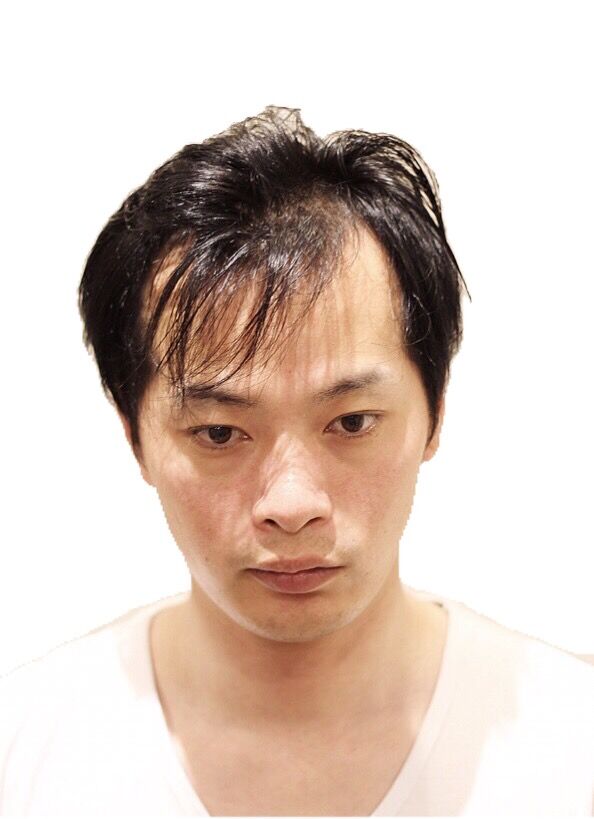 朗報 若ハゲ 美容院で誤魔化せてしまう 2ch野球まとめアンテナ