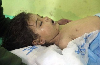 Syria gas attack 9