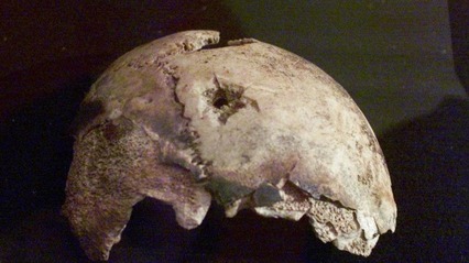Hitler's skull 2