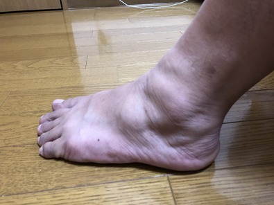 俺の足首 気合い入れんかd 関東黒鱒會blog 黒鱒回遊日記 Real
