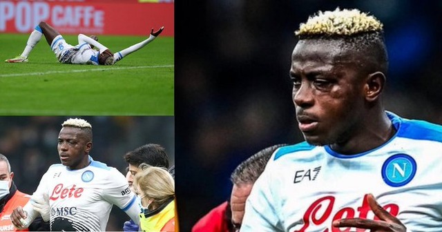 ◆閲覧注意◆顔面骨折のナポリFWオシムヘン、内部で目が宙ぶらりん状態…全治不明