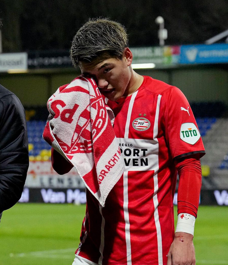 悲報 堂安律 Psv 相手選手と衝突で顔面から出血 おまとめニュース 赤井情報網