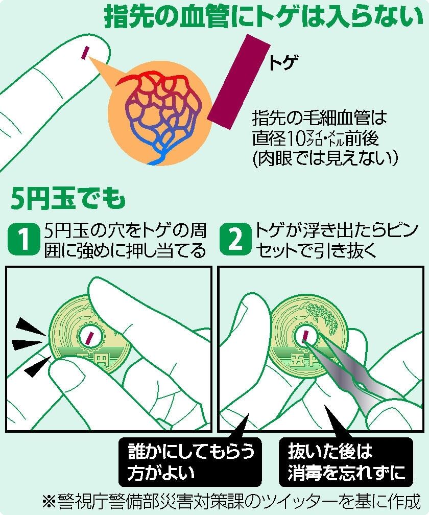 キリコは心臓に向かう折れ針 こんなこと本当に起こるのか医者に聞いてみた くるちゃんねる キリコは心臓に向かう折れ針 こんなこと本当に起こるのか医者に聞いてみた くるちゃんねる