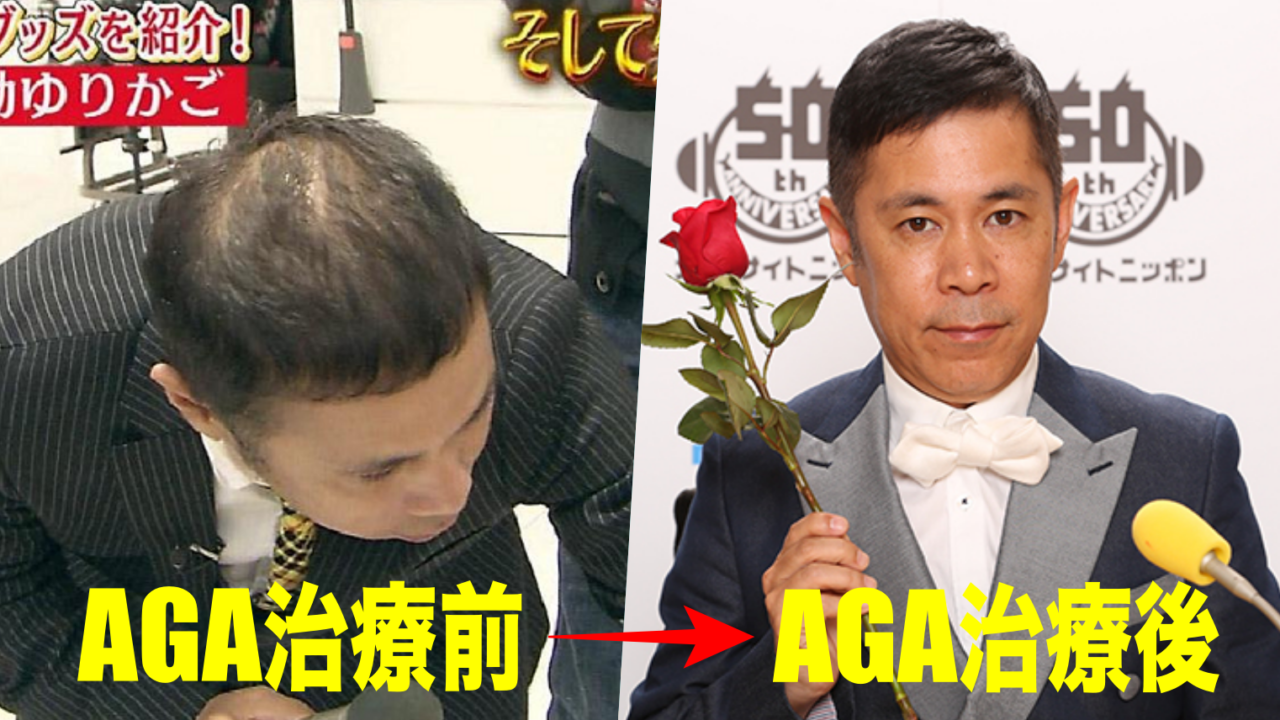 悲報 ナインティナイン矢部浩之さんの頭皮 限界か くるちゃんねる 悲報 ナインティナイン矢部浩之さんの頭皮 限界か くるちゃんねる