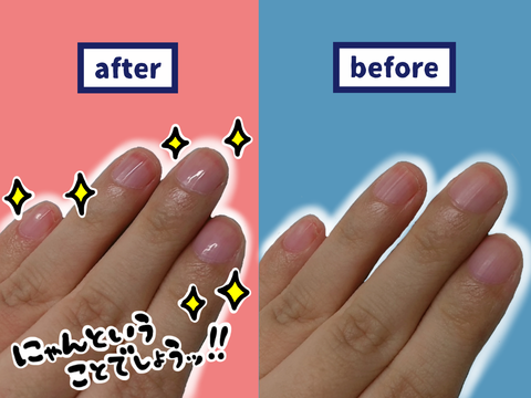 100均グッズで 爪 を磨いて 人見知り 克服 車イスにゃにゃのにゃんのその絵日記 100均グッズで 爪 を磨いて 人見知り 克服 車イスにゃにゃのにゃんのその絵日記