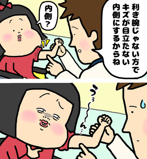 筋生検にてどこの筋肉を切り取りか説明を受ける