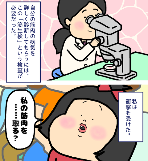 筋肉の病気の診断で必要な筋生検
