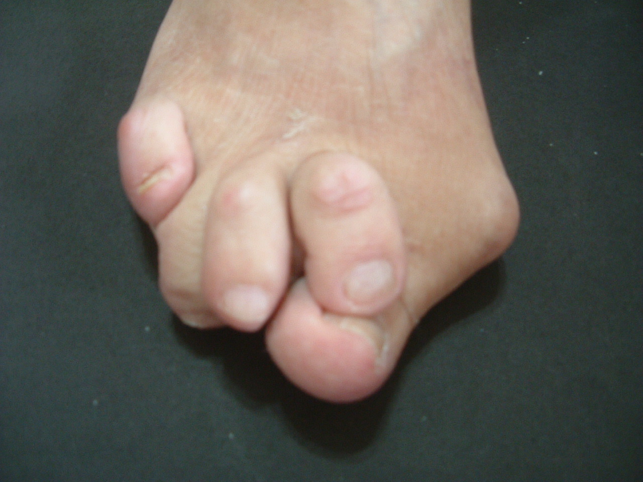 Sing 足の傷み 静岡発 靴づくり