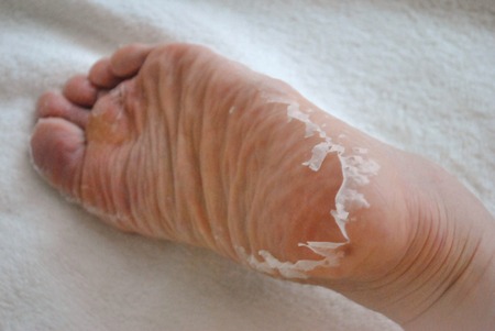 美人手帳 1時間スピードタイプが登場 ベビーフット イージーパックspt