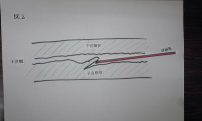 押してダメなら引いてみる 人工授精師 恭介