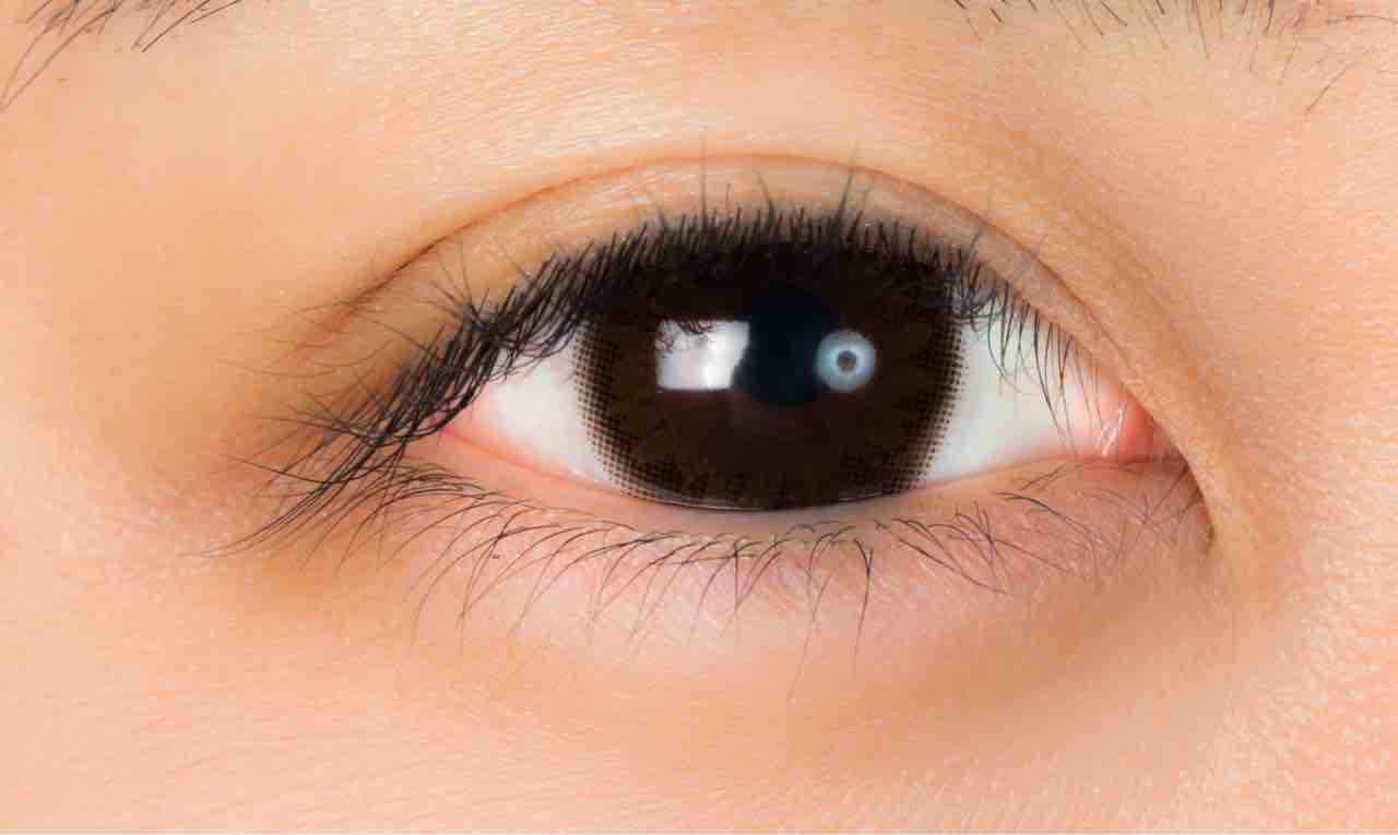 目尻のシワが気になって仕方ない 由紀子のわがまま美容クリニック