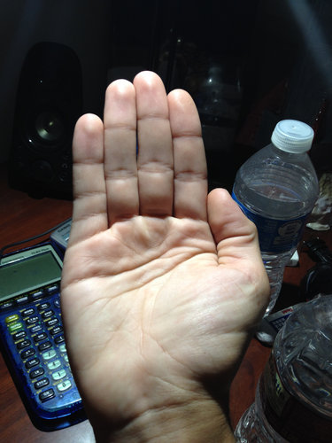 指に余分なシワ04