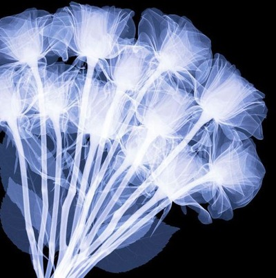 花のレントゲン02