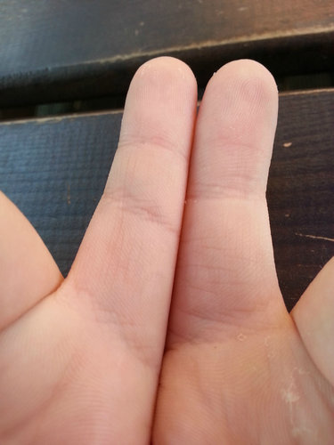 指に余分なシワ06