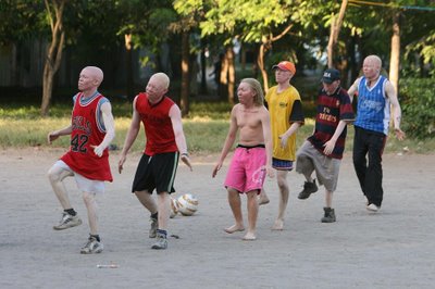 アルビノ黒人サッカーチーム02