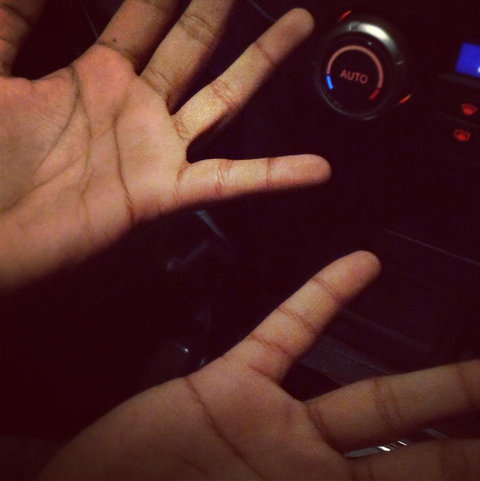 指に余分なシワ02