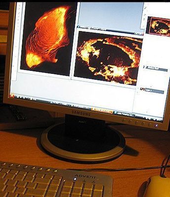 �ϴ�κ����01