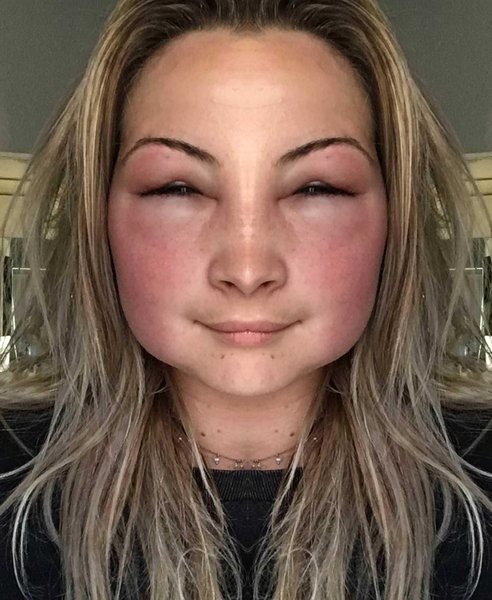若い女性 駆け出しの養蜂家だけど ハチに刺されちゃったところよ 直後の写真 らばq 若い女性 駆け出しの養蜂家だけど ハチに刺されちゃったところよ 直後の写真 らばq