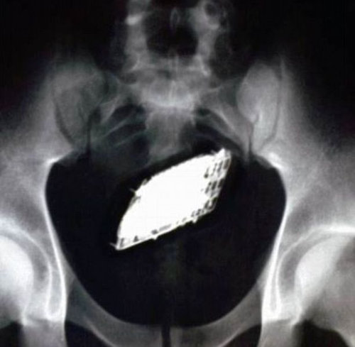 ブラジル刑務所に携帯電話を持ち込む方法06