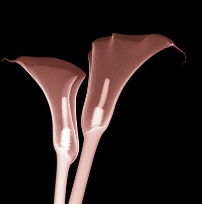 花のレントゲン03