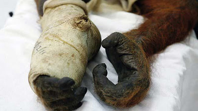 オランウータン骨折02