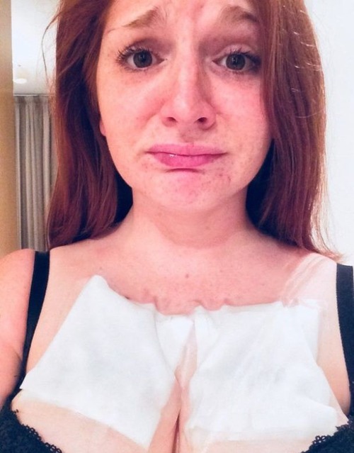 犬のタトゥーを入れて後悔04